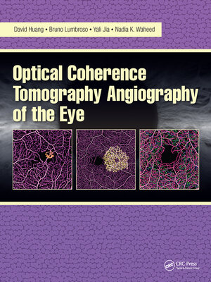 cover image of Optical Coherence Tomography Angiography of the Eye